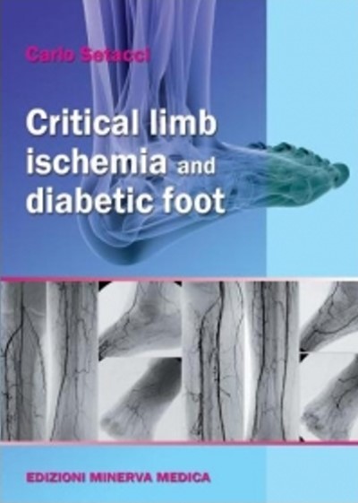 Critical limb ischemia and diabetic foot